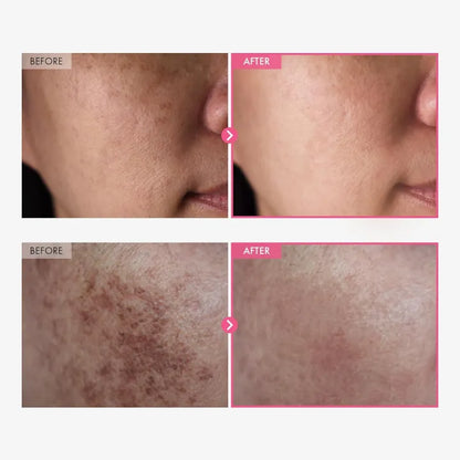 BRIGHTENING FACE CREAM